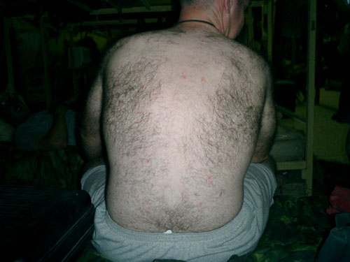 04 - Stewart; a hairy man with a head injury (2)